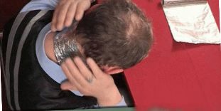 The treatment of the spine